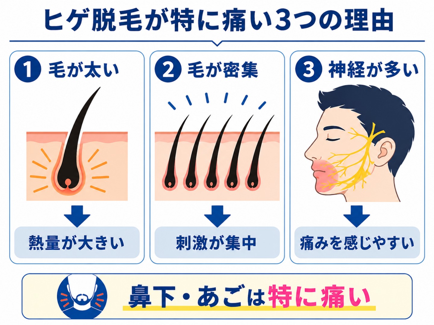 ヒゲ脱毛が特に痛い3つの理由