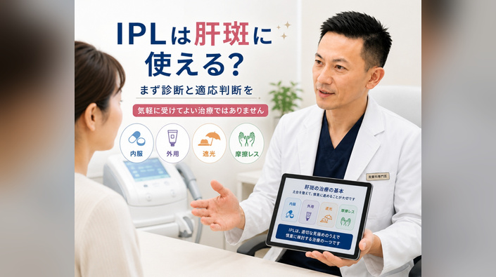 IPL・フォトフェイシャルは肝斑に使える？悪化リスクと正しい適応を解説のアイキャッチ