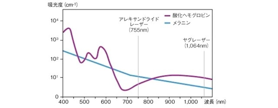 ジェントルマックスプロプラスの2つの波長