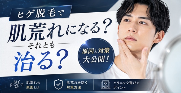 ヒゲ脱毛で肌荒れになる？それとも治る？原因と対策大公開！のアイキャッチ