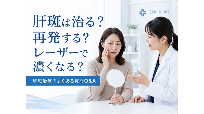 肝斑治療のよくある質問Q&A｜「治る？」「再発する？」「レーザーで濃くなる？」｜医師監修のアイキャッチ