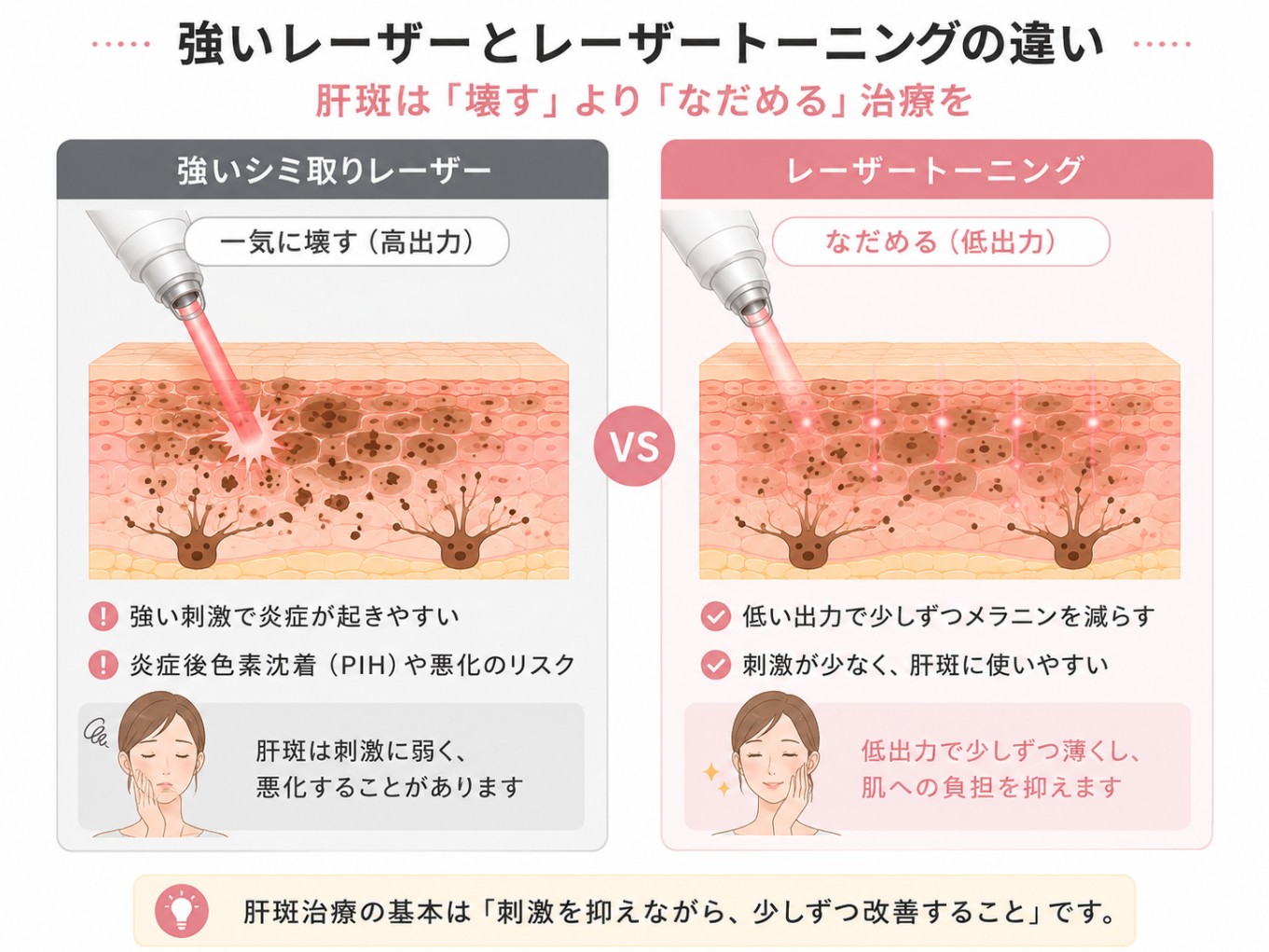 レーザー トーニング やりすぎ