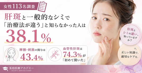 【女性113名調査】肝斑と一般的なシミで「治療法が違う」と知らなかった人は38.1%──摩擦・刺激の関与は43.4%、血管性肝斑は74.3%が「初めて聞いた」のアイキャッチ