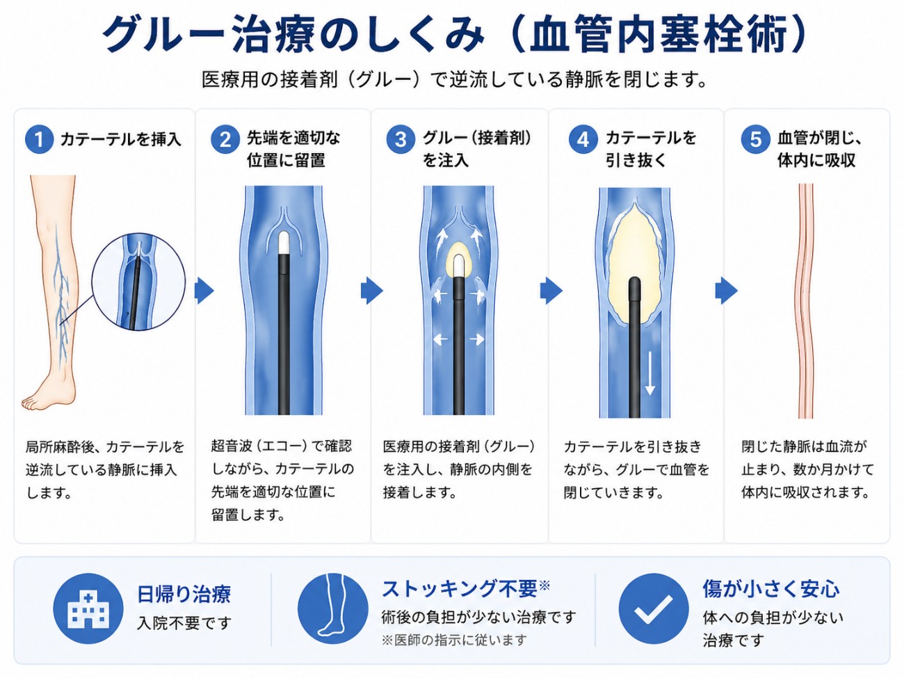 グルー治療のしくみ