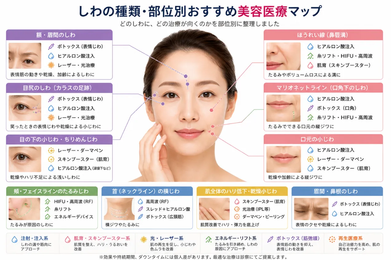 額・目元・ほうれい線・首のしわに合う美容医療の治療マップ