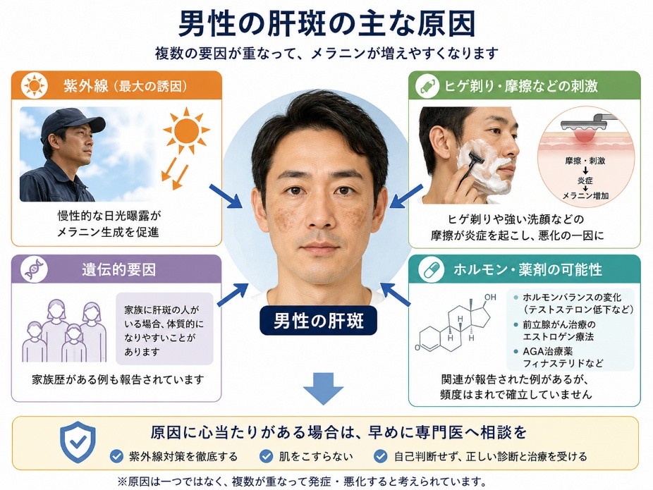 男性の肝斑の主な原因