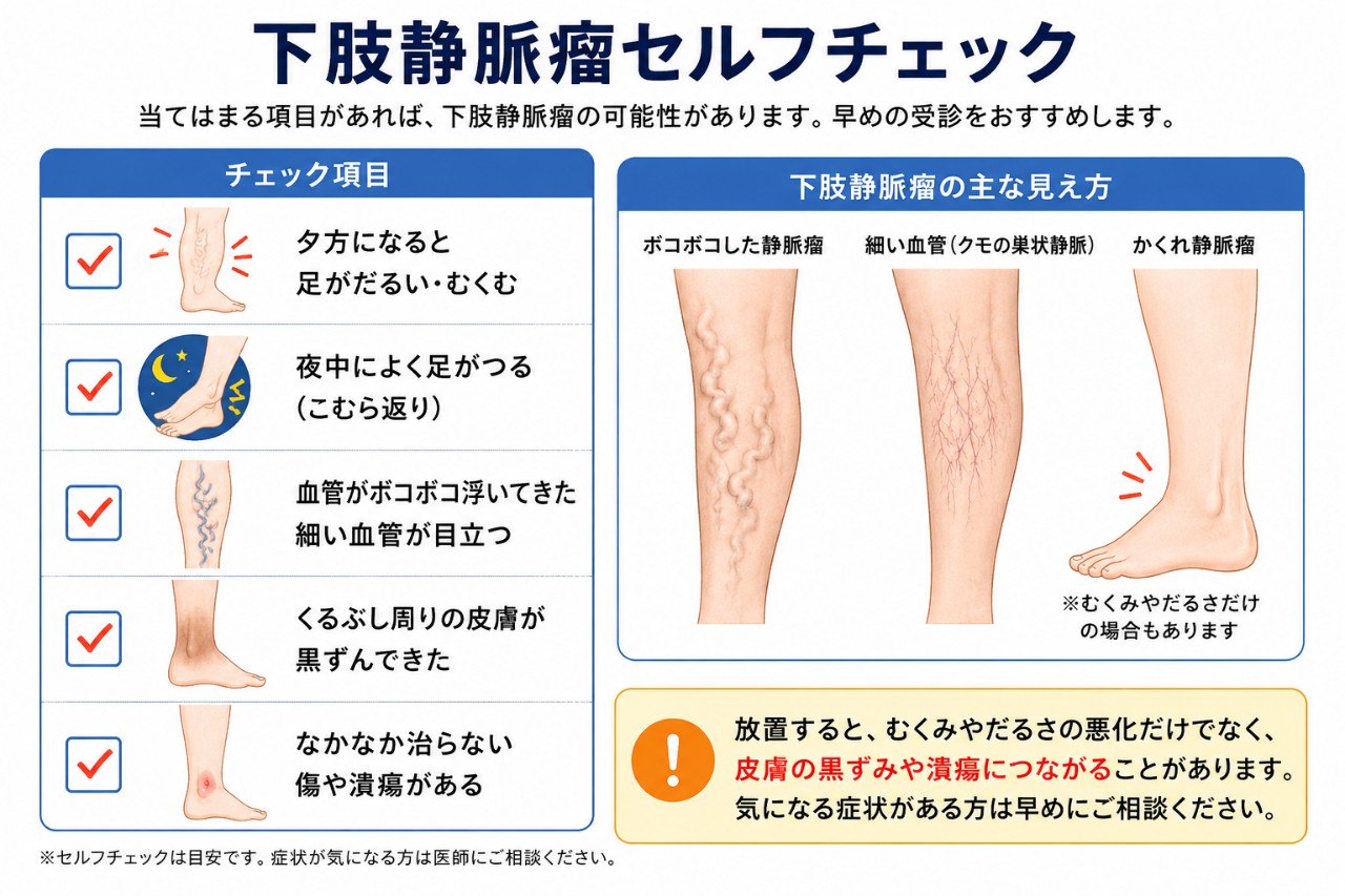 下肢静脈瘤のセルフチェックシート