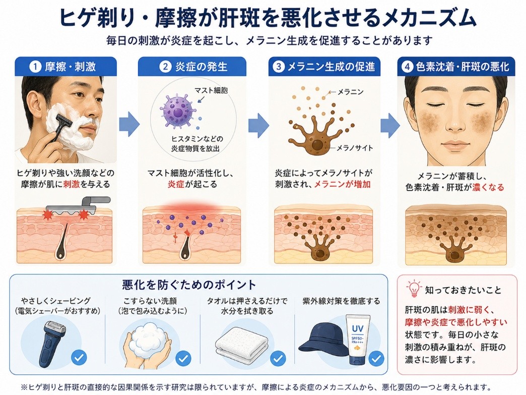 ヒゲ剃り・摩擦が肝斑を悪化させるメカニズム