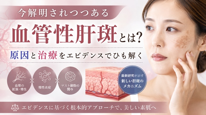 今解明されつつある血管性肝斑とは？原因と治療をエビデンスでひも解くのアイキャッチ