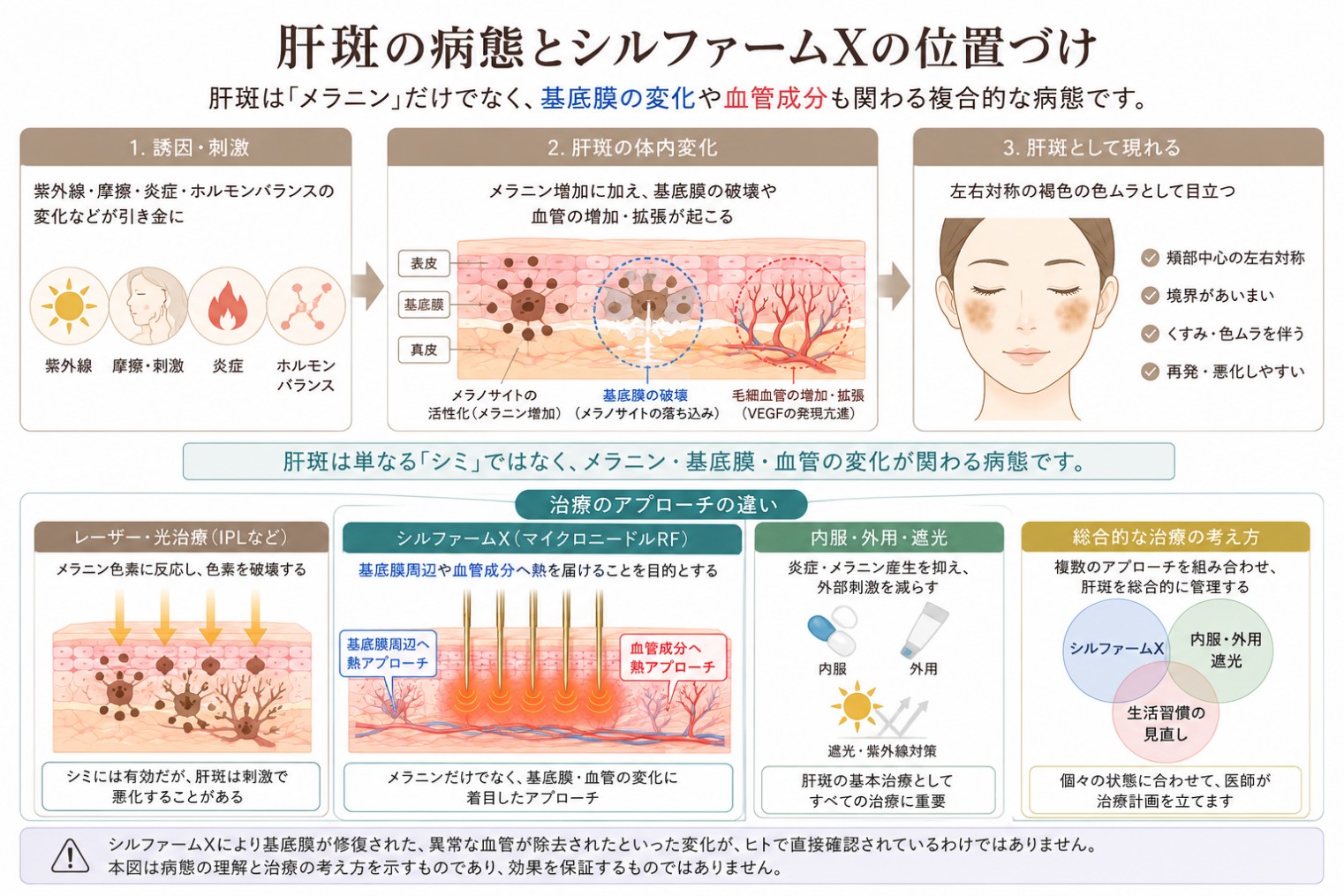 肝斑に関わるメラニン・基底膜・血管成分と治療の考え方