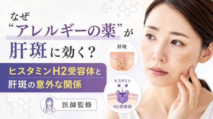 なぜ"アレルギーの薬"が肝斑に効く？ヒスタミンH2受容体と肝斑の意外な関係｜医師監修のアイキャッチ