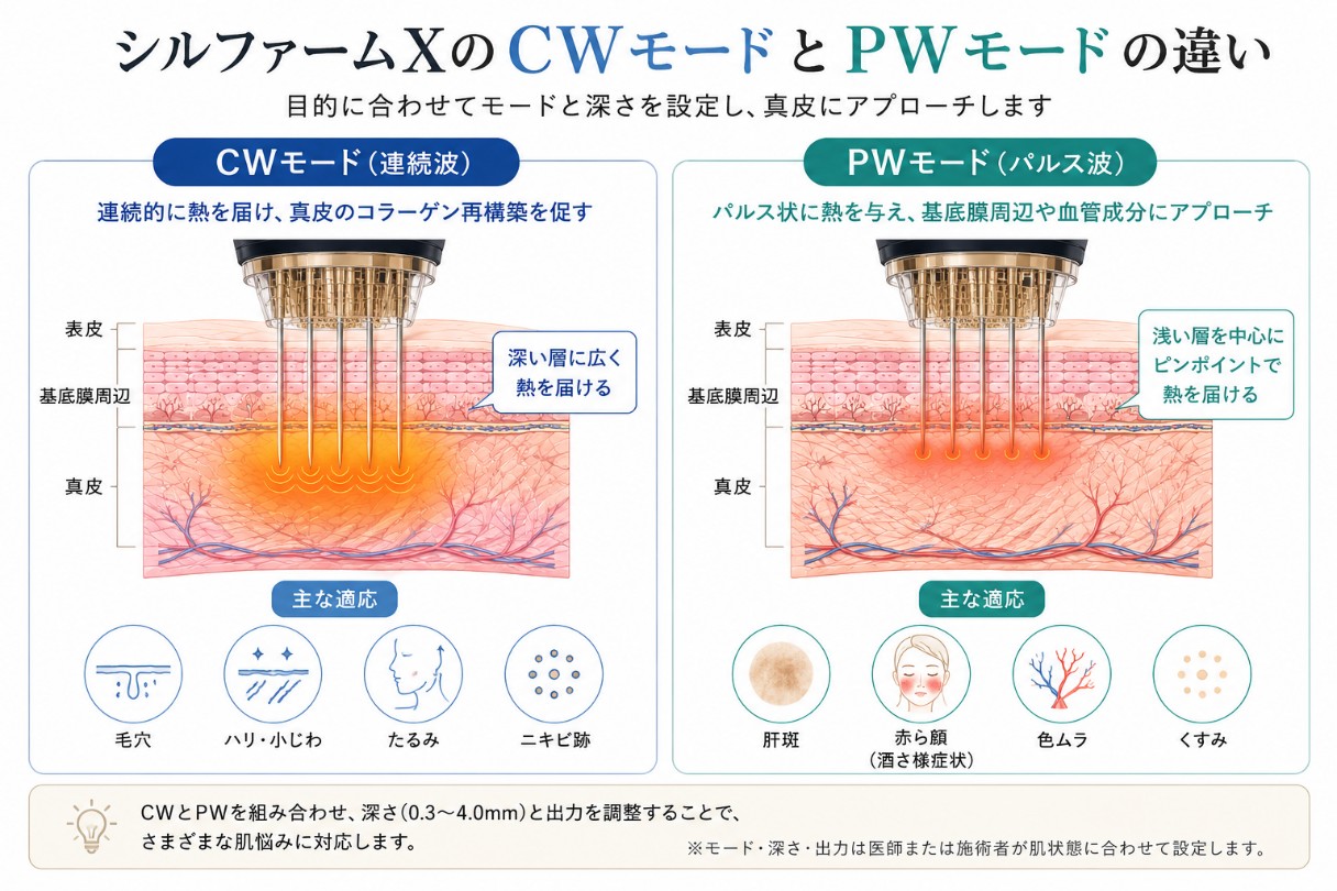 CW(連続波)とPW(パルス波)の違い