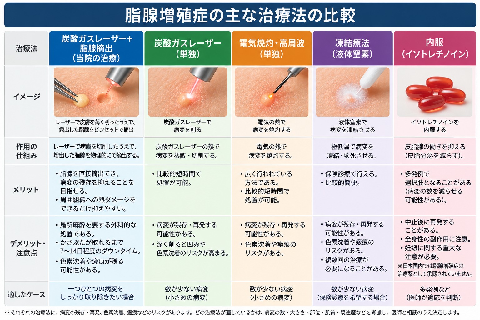 脂腺増殖症の主な治療法を炭酸ガスレーザー＋脂腺摘出、レーザー単独、電気焼灼・高周波、凍結療法、イソトレチノイン内服で比較した図